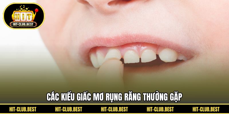 Các kiểu giấc mơ rụng răng thường gặp