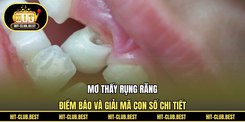 Mơ Thấy Rụng Răng